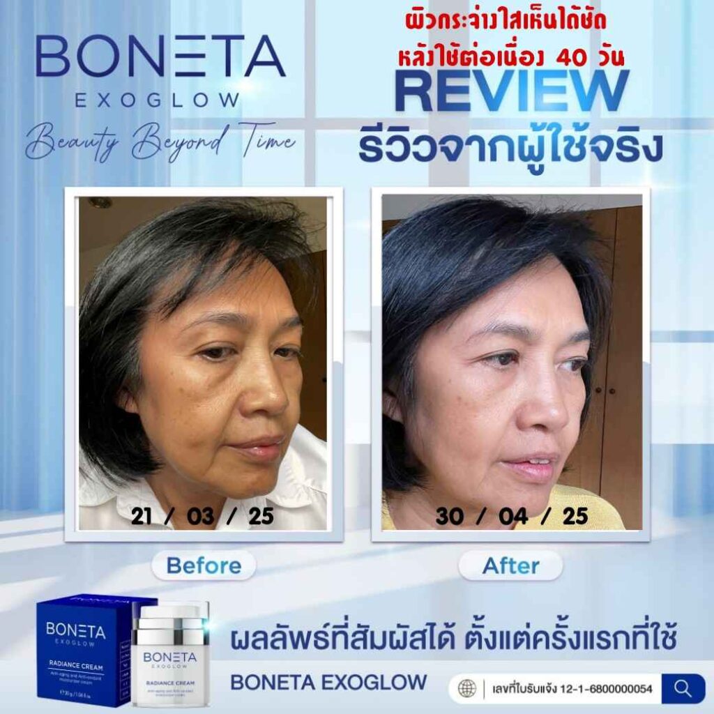 Boneta Cream ลดริ้วรอย ผิวชุ่มชื้น สว่างกระจ่างใส รอยดำ ฝ้า กระ โบเนต้า VONCE