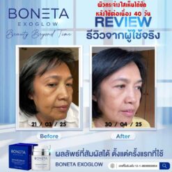 Boneta Cream ลดริ้วรอย ผิวชุ่มชื้น สว่างกระจ่างใส รอยดำ ฝ้า กระ โบเนต้า VONCE