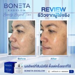 Boneta Cream ลดริ้วรอย ผิวชุ่มชื้น สว่างกระจ่างใส รอยดำ ฝ้า กระ โบเนต้า VONCE