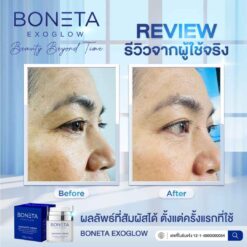 Boneta Cream ลดริ้วรอย ผิวชุ่มชื้น สว่างกระจ่างใส รอยดำ ฝ้า กระ โบเนต้า VONCE