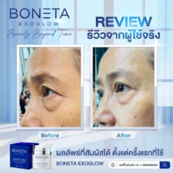 Boneta Cream ลดริ้วรอย ผิวชุ่มชื้น สว่างกระจ่างใส รอยดำ ฝ้า กระ โบเนต้า VONCE