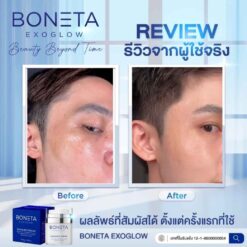 Boneta Cream ลดริ้วรอย ผิวชุ่มชื้น สว่างกระจ่างใส รอยดำ ฝ้า กระ โบเนต้า VONCE